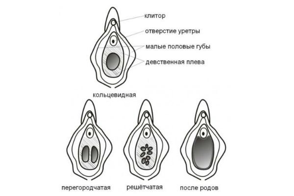 Jarrohlikda defloratsiya