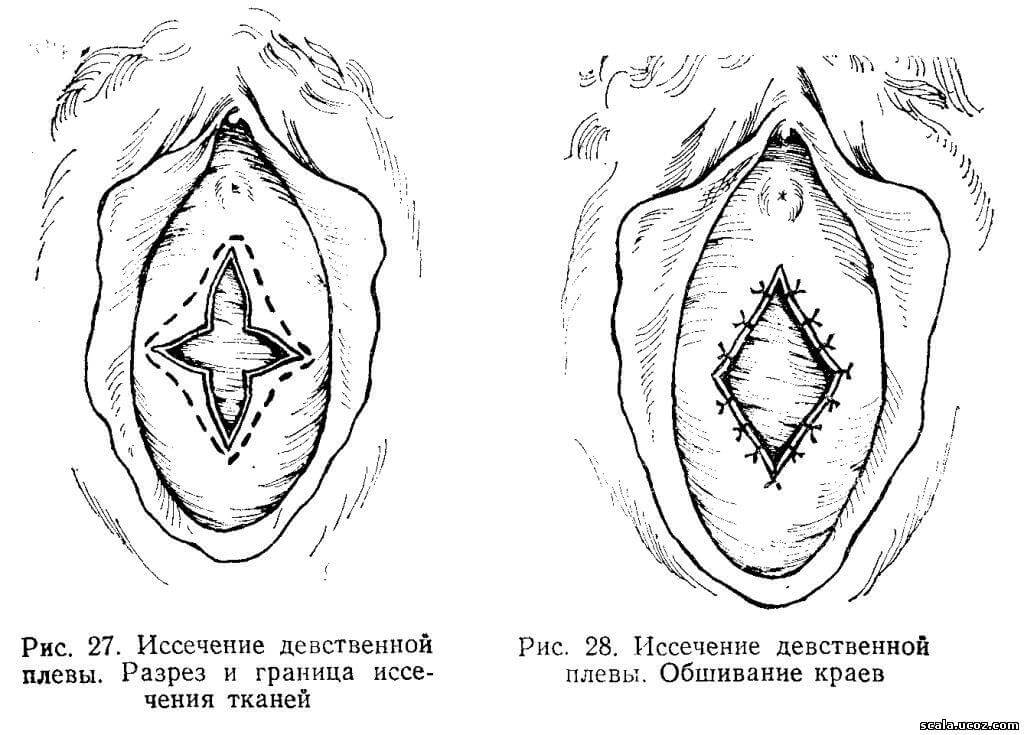 Barkamollikni tiklash